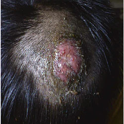 Kerion scalp fungus